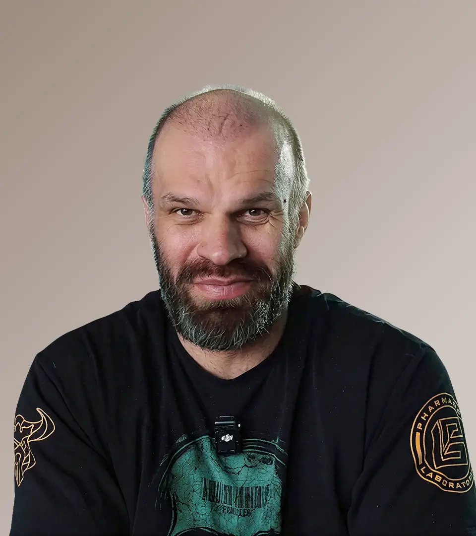 Пересадка волос у Дениса Цыпленкова