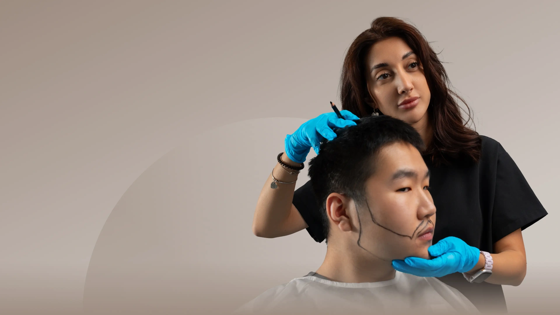 Пересадка волос на бороду