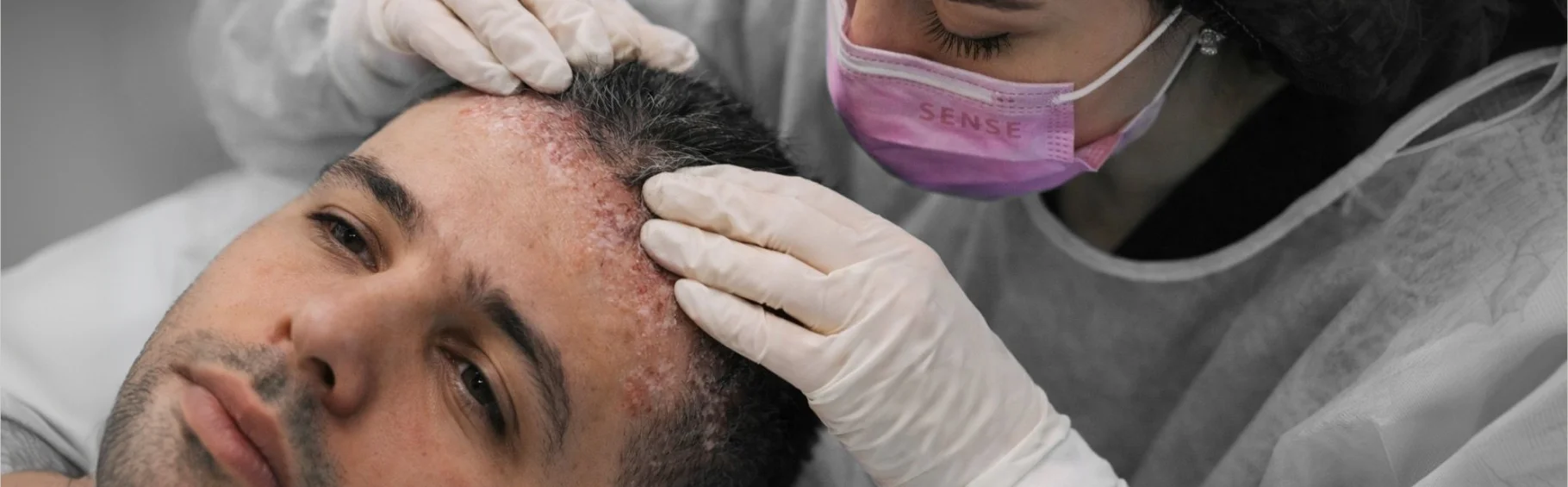 Периоральный дерматит