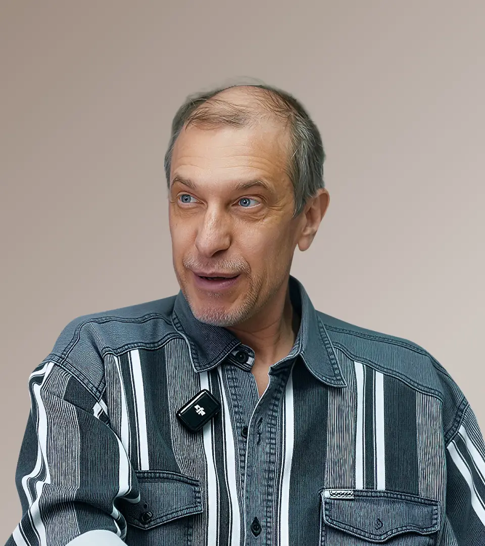 Пересадка волос у Сергея Соседова