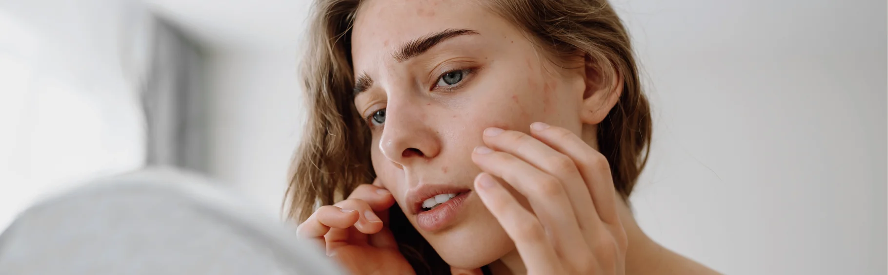 Пигментные пятна на лице