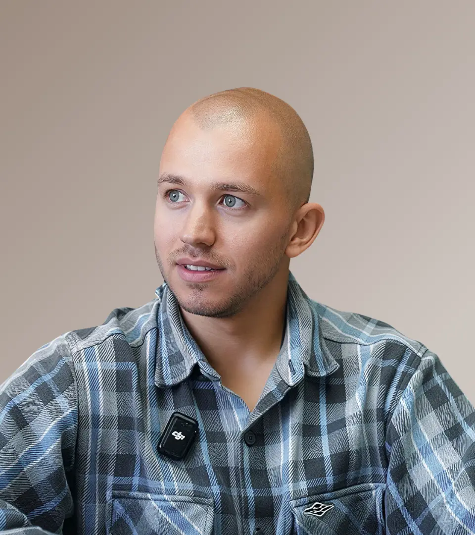 Пересадка волос у Сергея Романовича