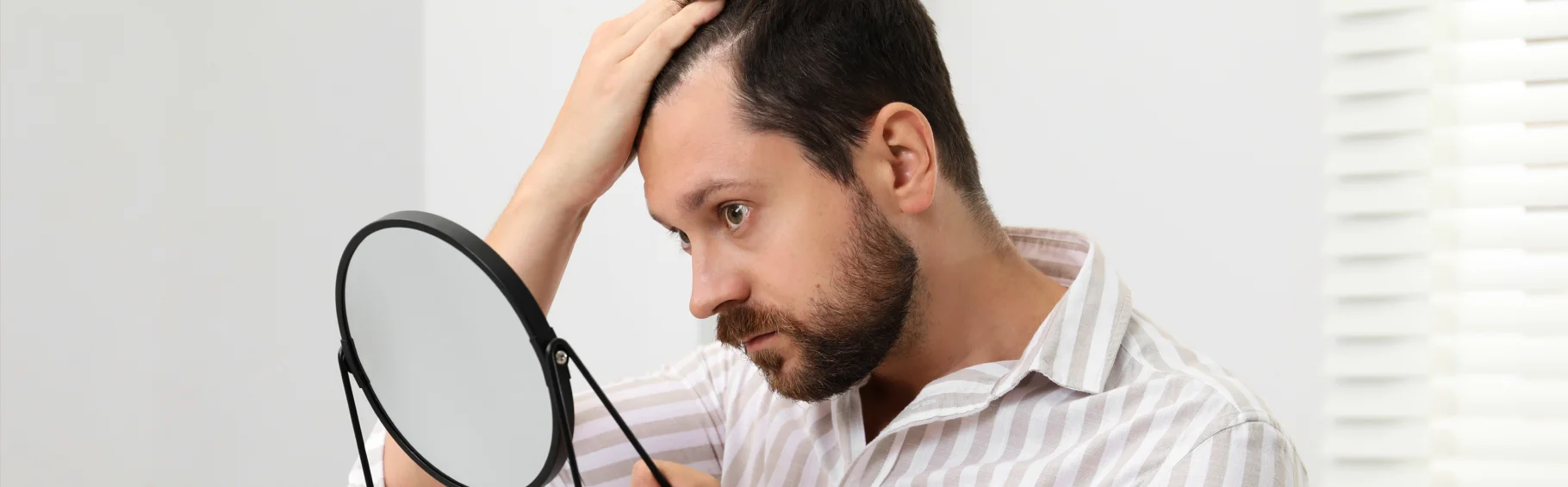15 причин выпадения волос у мужчин