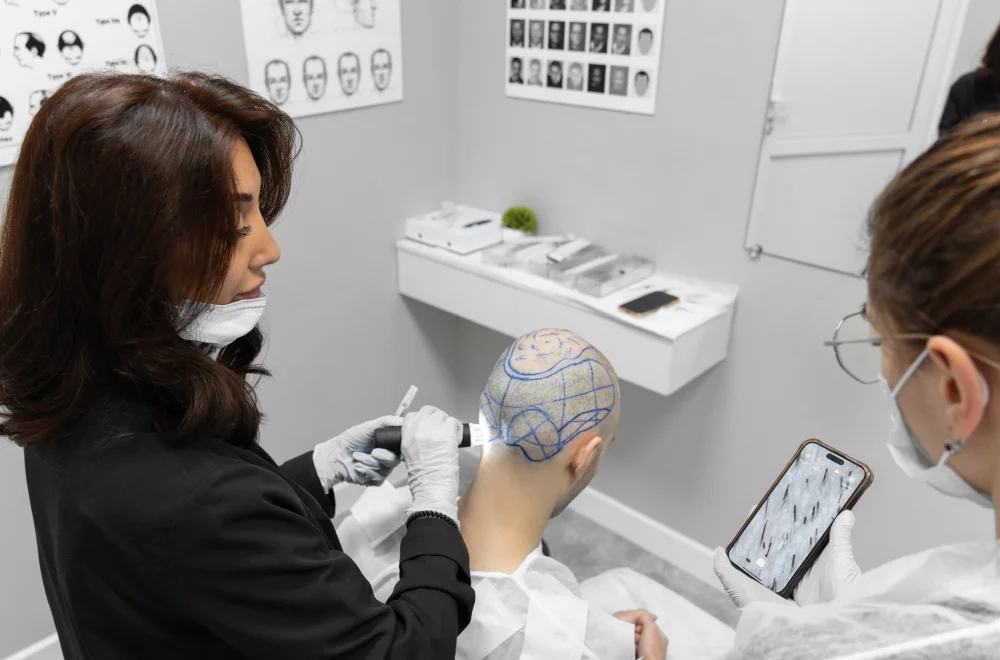 Формирование линии роста волос и зоны пересадки